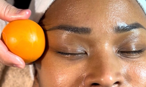 VITAMINA C VITAMINA C